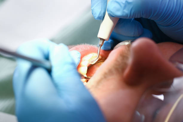 Best Emergency Denture Repair in Wlow Springs, IL