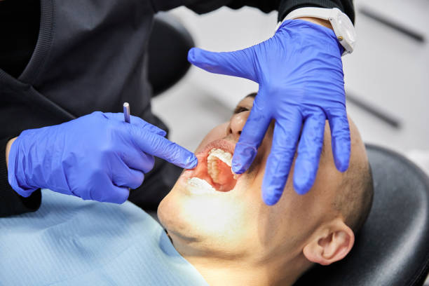 Best Emergency Tooth Extraction in Wlow Springs, IL